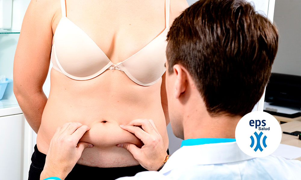 Abdominoplastia Sevilla: La abdominoplastia antes y después